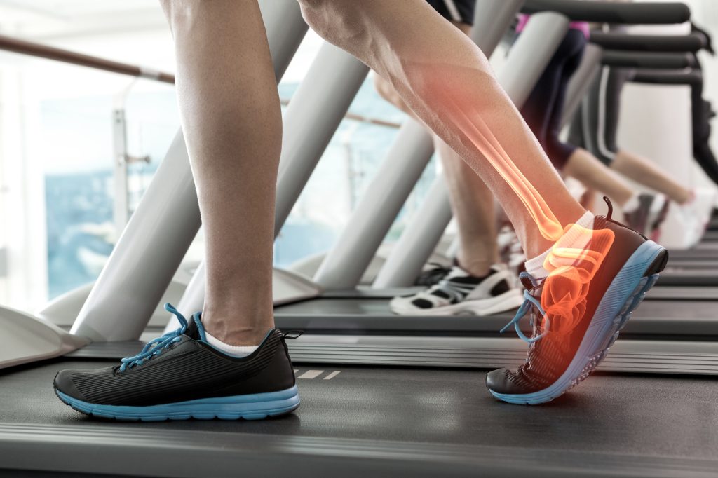 Runner holding lower leg in pain from shin splints during outdoor run